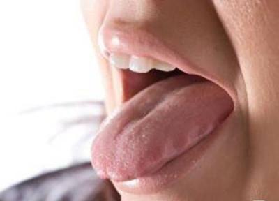 خال این رنگی داخل دهان یعنی سرطان زبان!